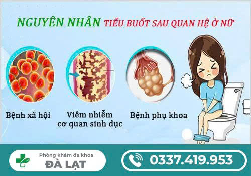 Hình ảnh minh họa